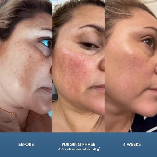 Peach & Lily - Matcha Pudding Antioxidant Cream (1.69 fl oz) - Face Moisturizer Cream - Protect & Hydrate Skin - Green Tea, Vitamin B3, Niacinamide - Self Care - Vegan, Cruelty Free - Korean Skincare