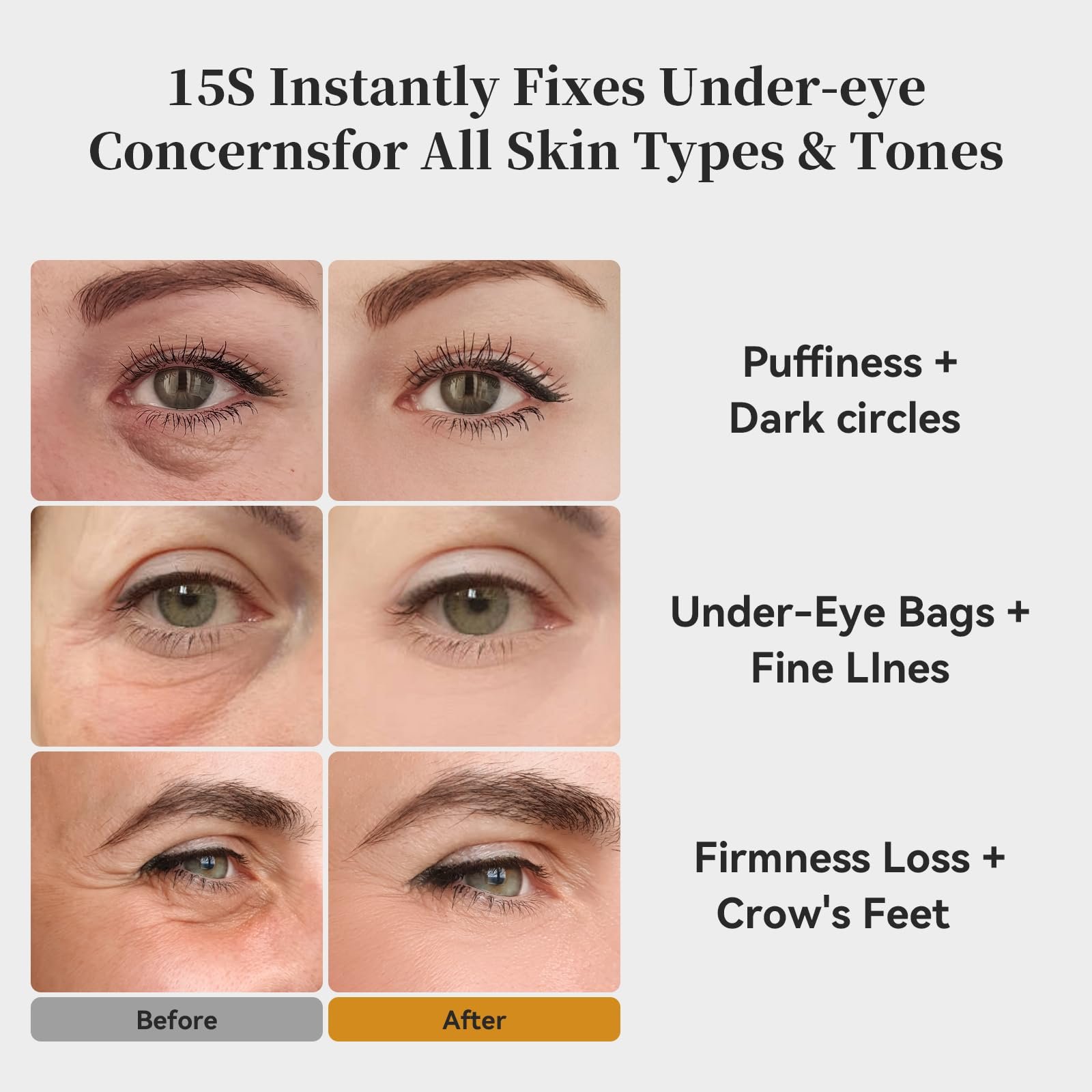 KOKN 15S Instant Firmx Eye&Face Cream | Temporary Eye Tightener | Smooths Wrinkles,Puffy Eyes & Bags | 4-IN-1 Skincare| 5000ppm PDRN,Panthenol,Collagen Formula for LongTerm Repair, 0.71 Fl Oz