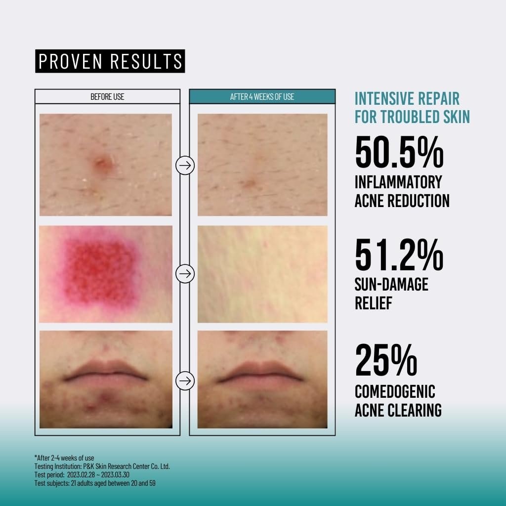 Jumiso Snail Mucin 95 + Peptide Facial Essence, 4.73 fl oz (140 ml)