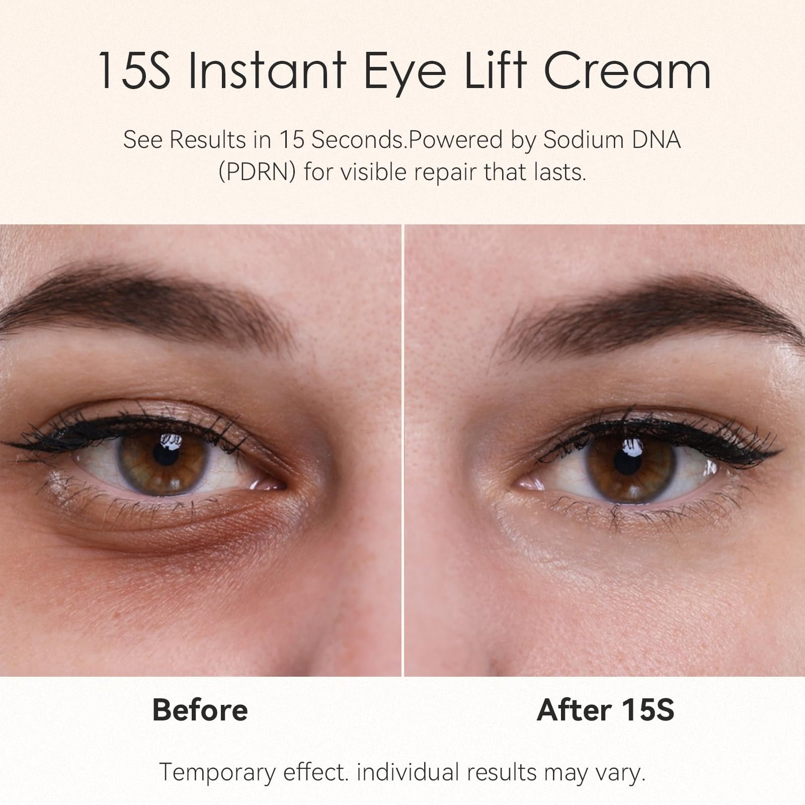 15-Second Instant Eye Lift Cream with Sodium DNA & 0.1% Retinal | Rapid Tightening for Eye Bags & Fine Lines | Dual-Action Firming + Long-Term Repair | Caffeine, Peptides & Collagen Complex | 0.7fl oz