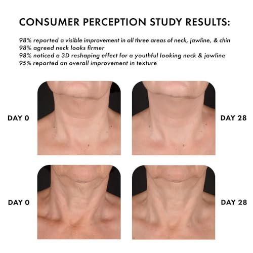 Whish Neck Firming Cream with Bakuchiol - 3D Reshaping Effect for Neck, Jawline & Chin - 3.4oz